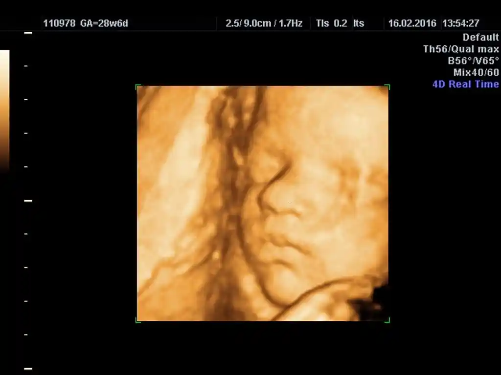 3d ultrasound baton rouge louisiana