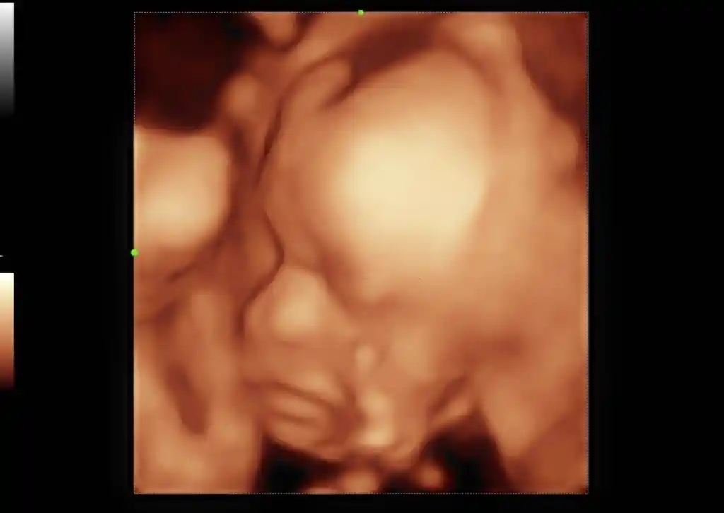 4d ultrasound baton rouge louisiana