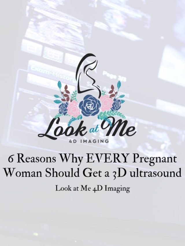 6 REASONS WHY EVERY PREGNANT WOMAN SHOULD GET A 3D ULTRASOUND