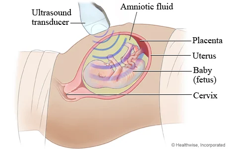 fetal ultrasound diagram