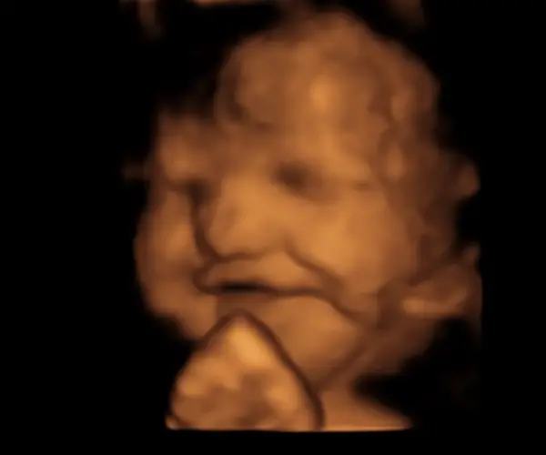 look at me 2d ultrasound livingston louisiana