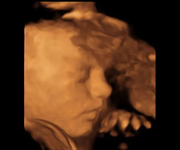 look at me 3d 4d ultrasound livingston louisiana 12