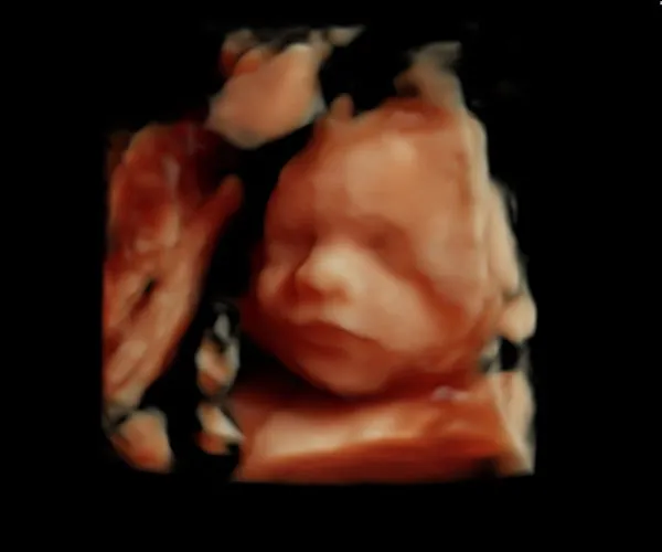 look at me 3d 4d ultrasound livingston louisiana 13