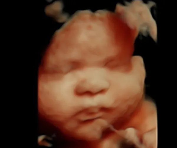 look at me 3d 4d ultrasound livingston louisiana 15