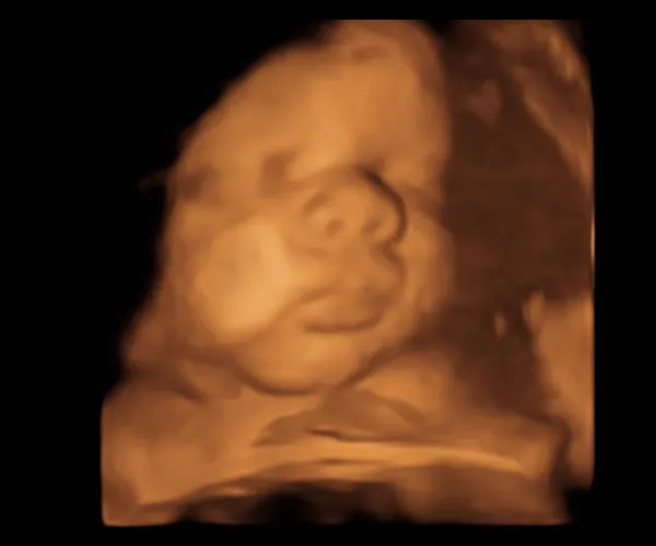 look at me 3d 4d ultrasound livingston louisiana 17