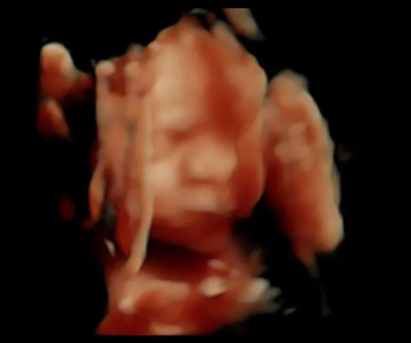 look at me 3d 4d ultrasound livingston louisiana 18