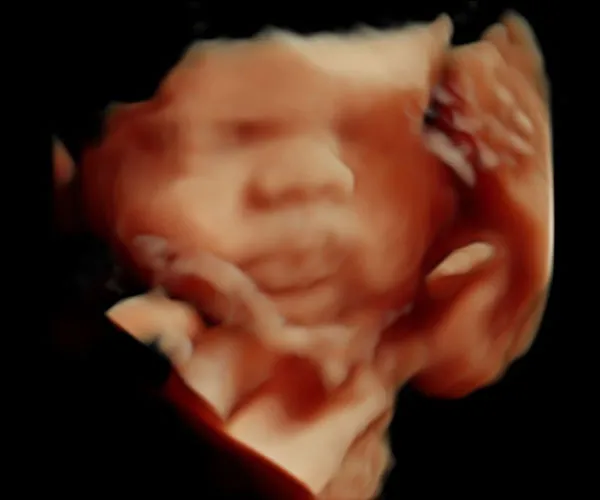 look at me 3d 4d ultrasound livingston louisiana 19