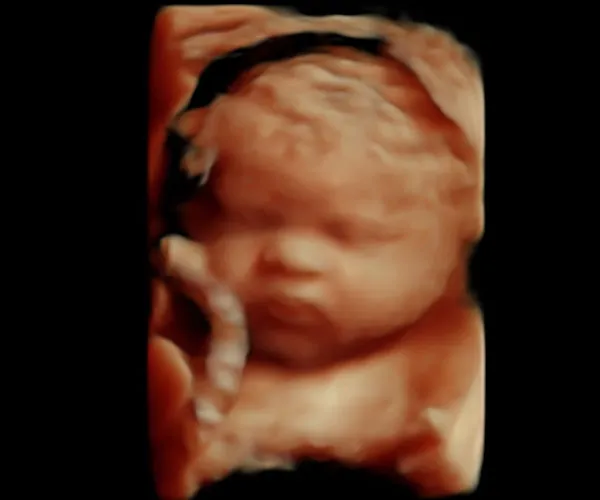 look at me 3d 4d ultrasound livingston louisiana 2