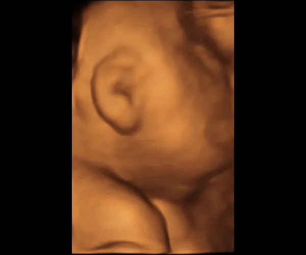 look at me 3d 4d ultrasound livingston louisiana 20