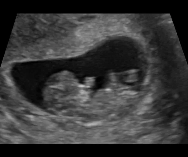 look at me 3d 4d ultrasound livingston louisiana 21