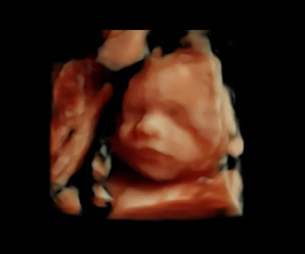 look at me 3d 4d ultrasound livingston louisiana 22