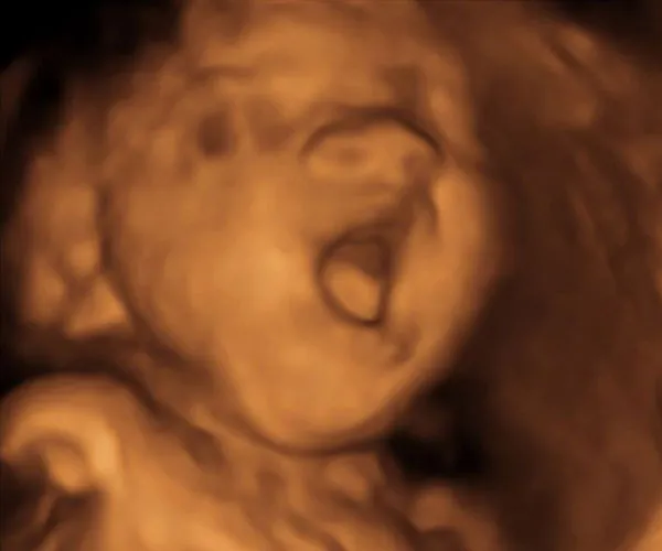 look at me 3d 4d ultrasound livingston louisiana 23