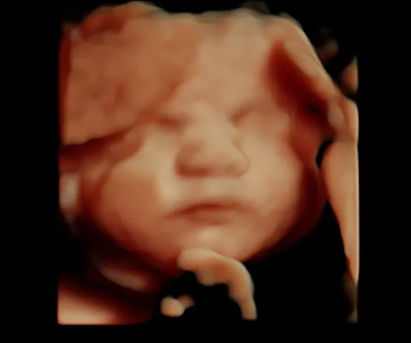 look at me 3d 4d ultrasound livingston louisiana 3