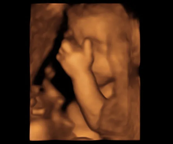 look at me 3d 4d ultrasound livingston louisiana 5