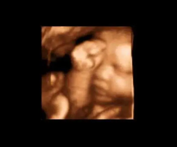 look at me 3d 4d ultrasound livingston louisiana 6