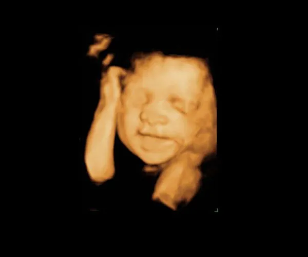 look at me 3d 4d ultrasound livingston louisiana 8