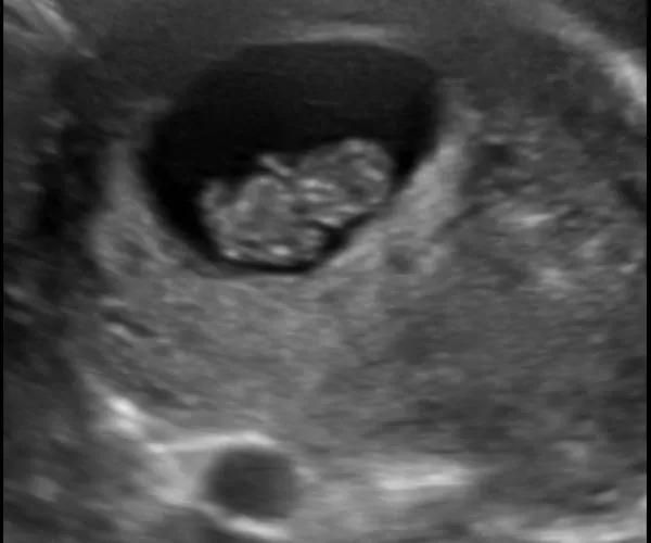 look at me 3d 4d ultrasound livingston louisiana 9