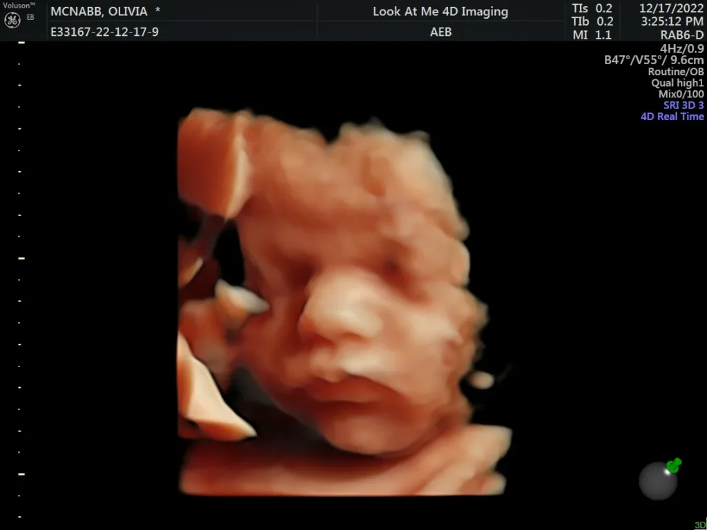 look at me 4d imaging 3d ultrasound screenshot 14