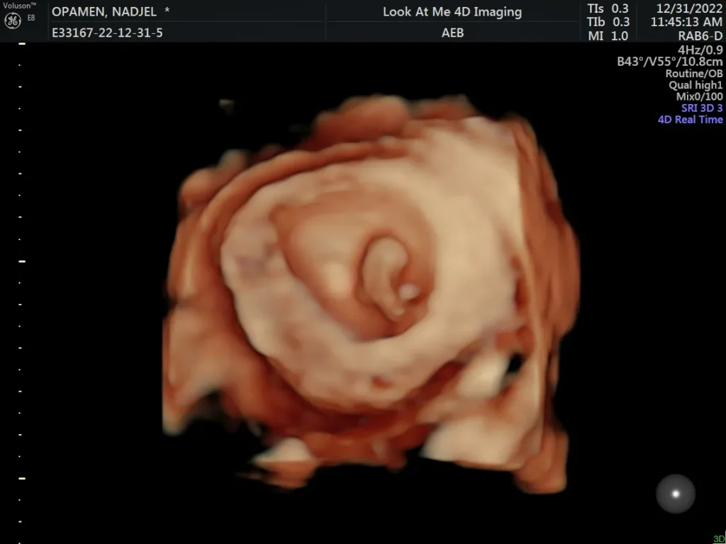 look at me 4d imaging 3d ultrasound screenshot 17