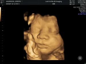 look at me 4d imaging 3d ultrasound screenshot 3