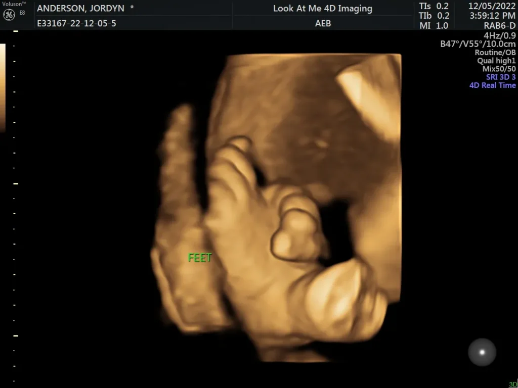 look at me 4d imaging 3d ultrasound screenshot 4