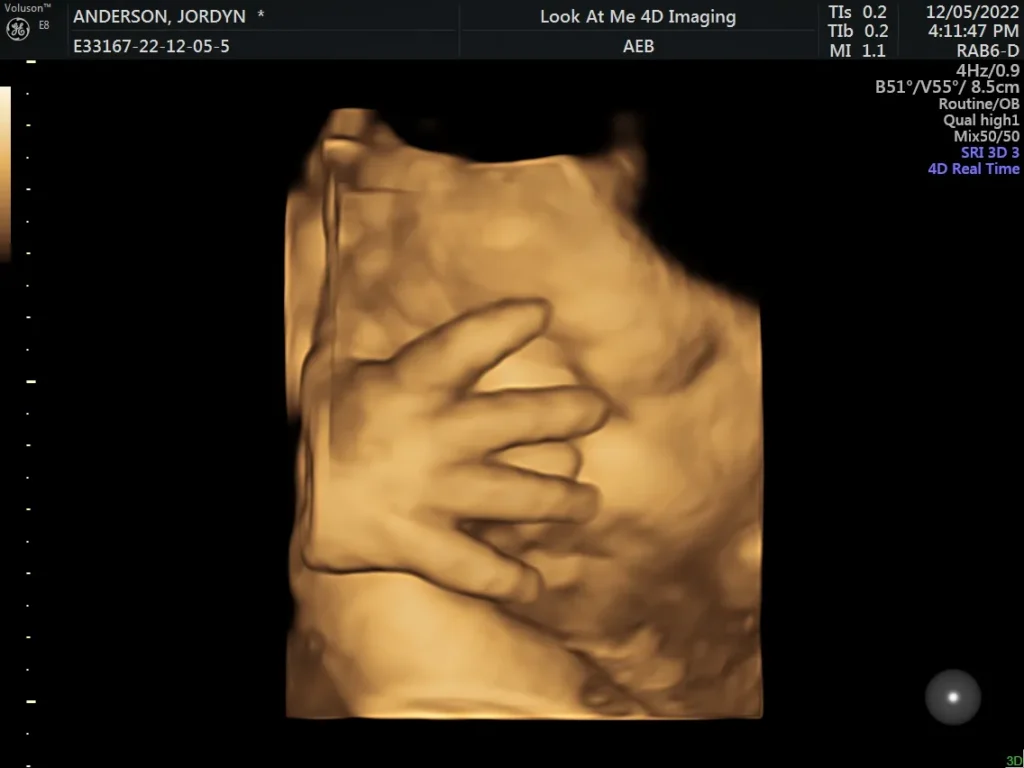 look at me 4d imaging 3d ultrasound screenshot 5