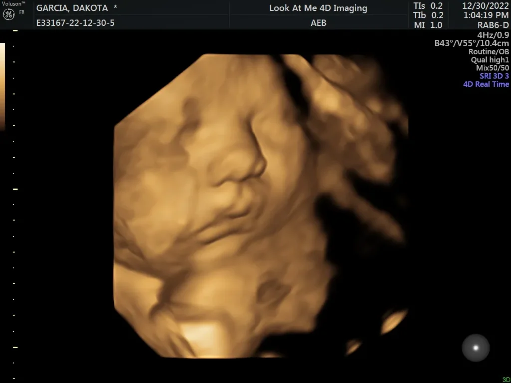 look at me 4d imaging 3d ultrasound screenshot 6