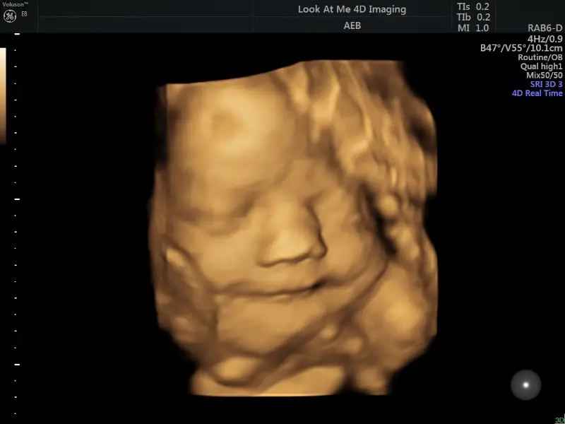 look at me 4d imaging baton rouge 3d ultrasound image gallery 21