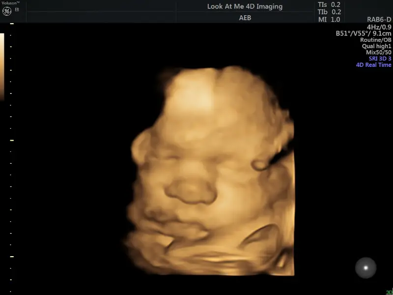 look at me 4d imaging baton rouge 3d ultrasound image gallery 25