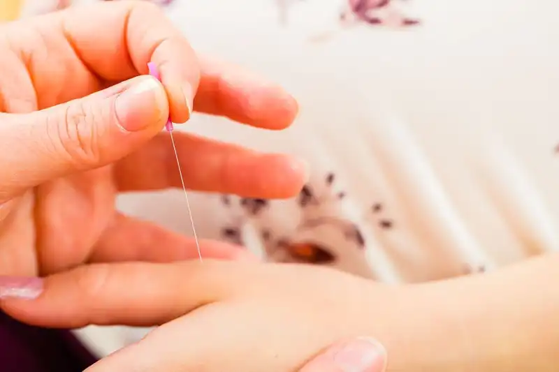 pregnancy acupuncture safe